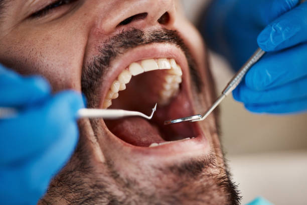 Best Urgent Care for Lost Fillings or Crowns in East Lansing, MI